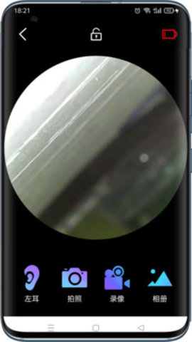 可视采耳仪app官方版v1.0.5