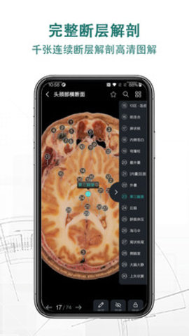 掌上3D解剖app手机版v2.0.0