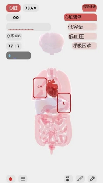 生命人体模拟器life汉化版v1.0